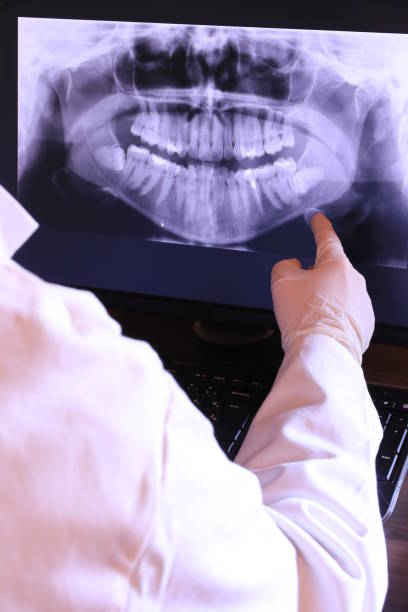 Best Emergency Dental Extractions in Tomahawk, WI