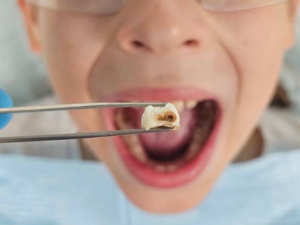 Best Mobile Emergency Dentist in Tomahawk, WI