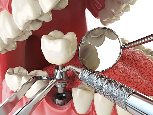 Best Broken or Cracked Tooth Emergency Dentist in Tomahawk, WI
